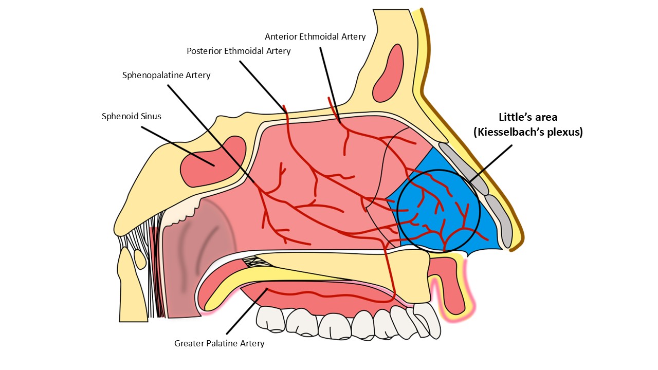 Epistaxis_CPG_Saggital Little's Area